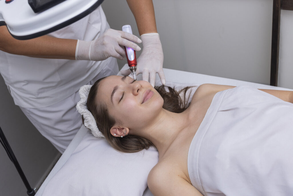 microneedling-treatment